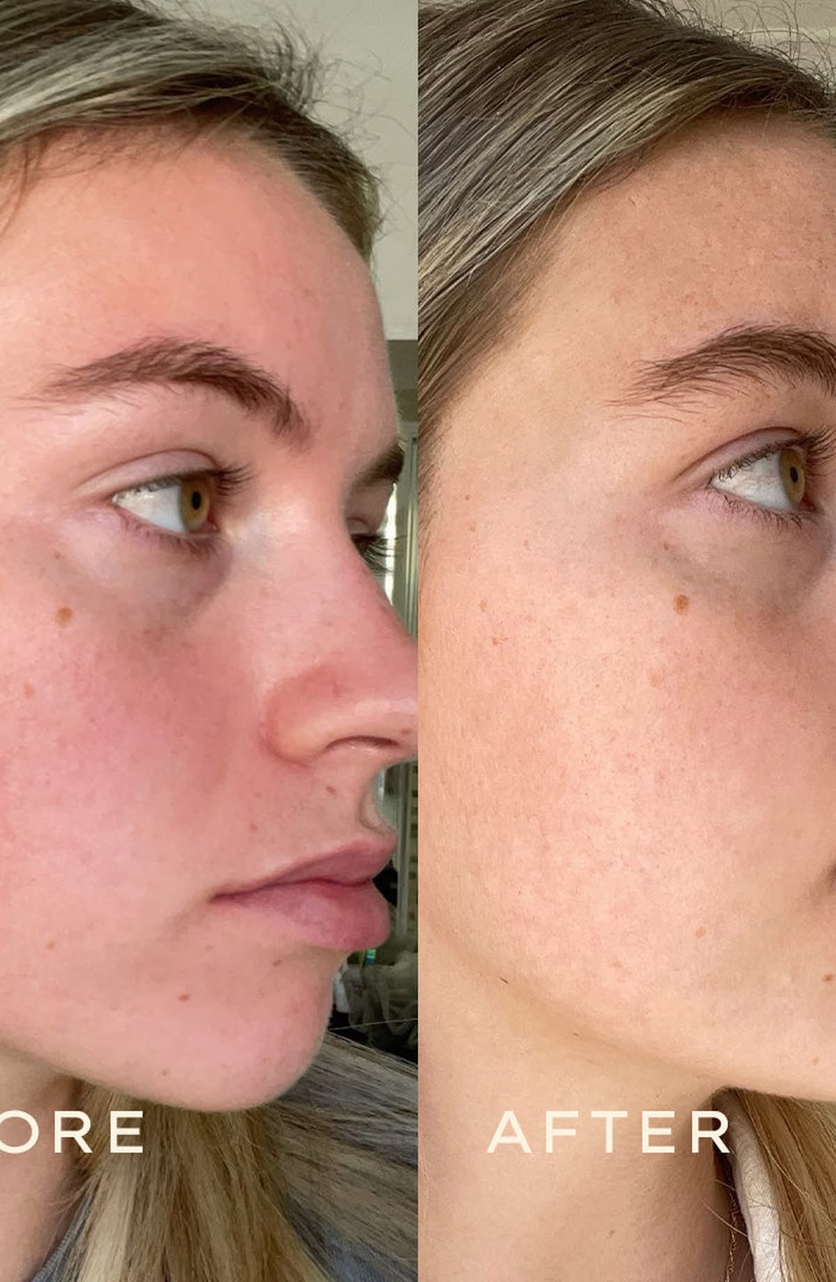 LED Therapy Face Mask